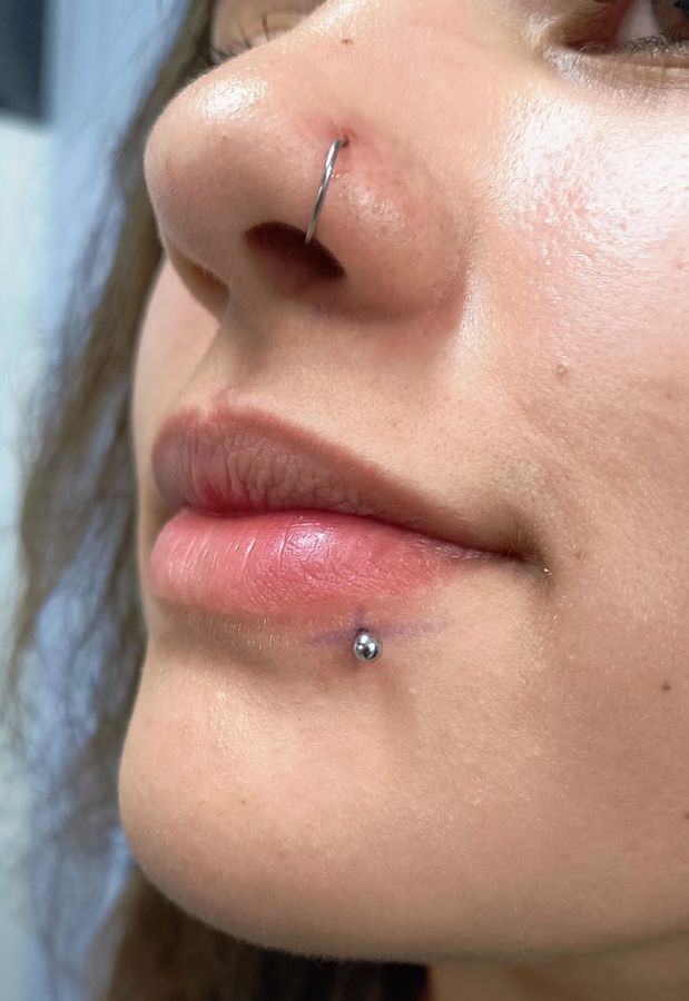 Conch — titânio grau de implante